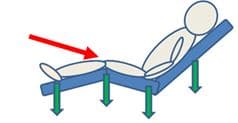 profiling bed
