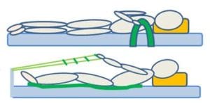 bed rails, ladder and slide sheet